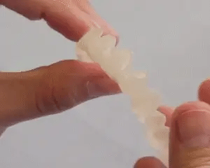 Custom-Fit Removable Veneers for Upper and Lower Teeth – Natural Smile Solution