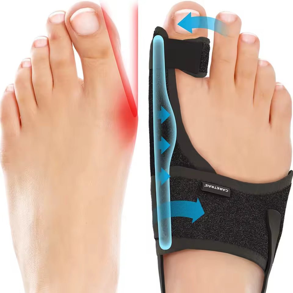 Night Splint for Hallux Valgus | Ergonomic Adjustable Design | Velcro Strap & Comfortable Fit