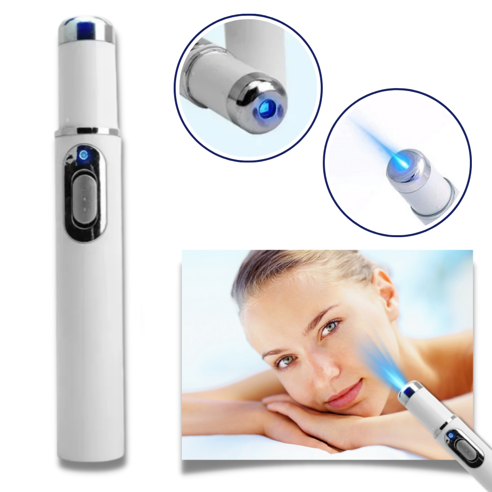 Portable Blue Light Skin Pen | Targeted Scar & Hyperpigmentation Treatment | Battery-Operated Travel Size