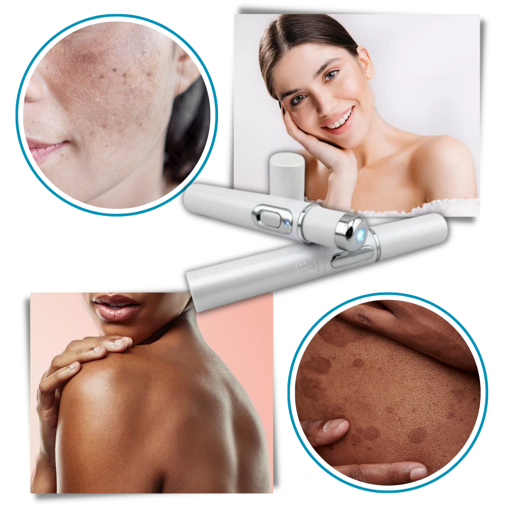 Portable Blue Light Skin Pen | Targeted Scar & Hyperpigmentation Treatment | Battery-Operated Travel Size