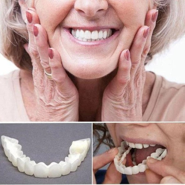 Removable Smile Veneers Set | Thin Realistic Acrylic Design | Upper & Lower Set with Molds