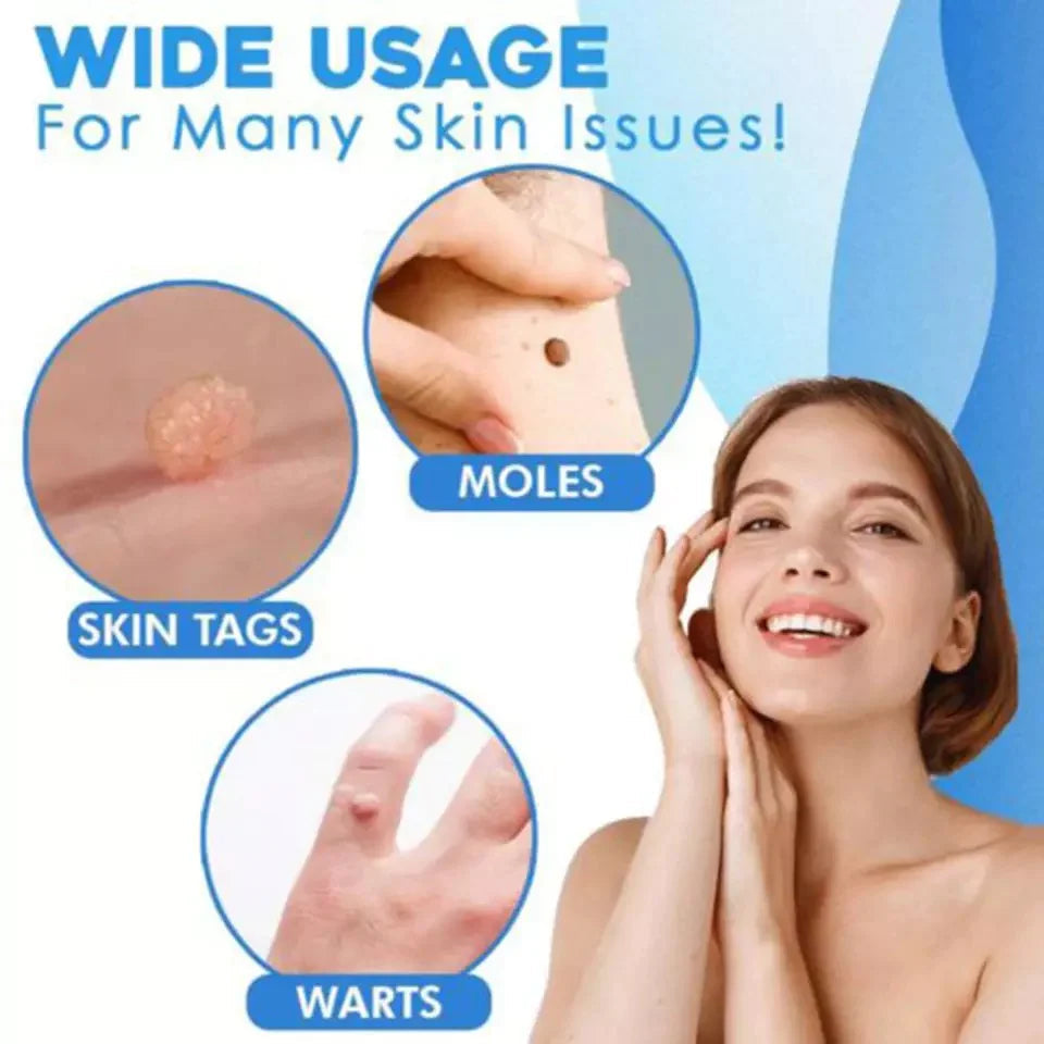 Skin Tag Removal Kit | Automatic Band Applicator | 44-Pack Bands & Remover Tools | Easy At-Home Use
