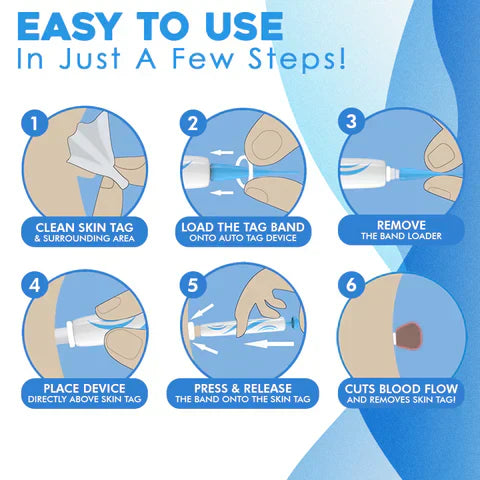 Skin Tag Removal Kit | Automatic Band Applicator | 44-Pack Bands & Remover Tools | Easy At-Home Use