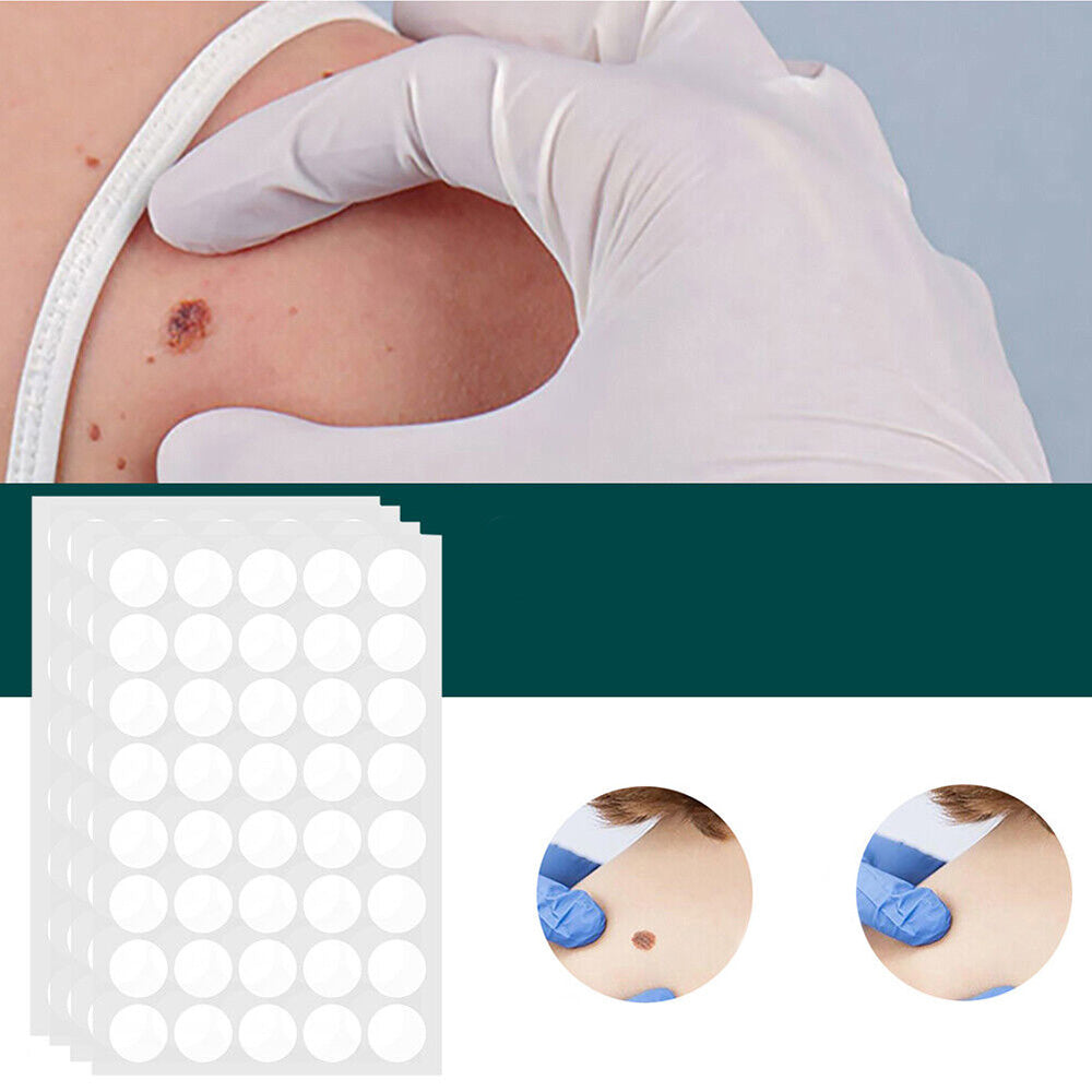 Skin Tag & Wart Patches | Painless & Discreet | 120-Pack
