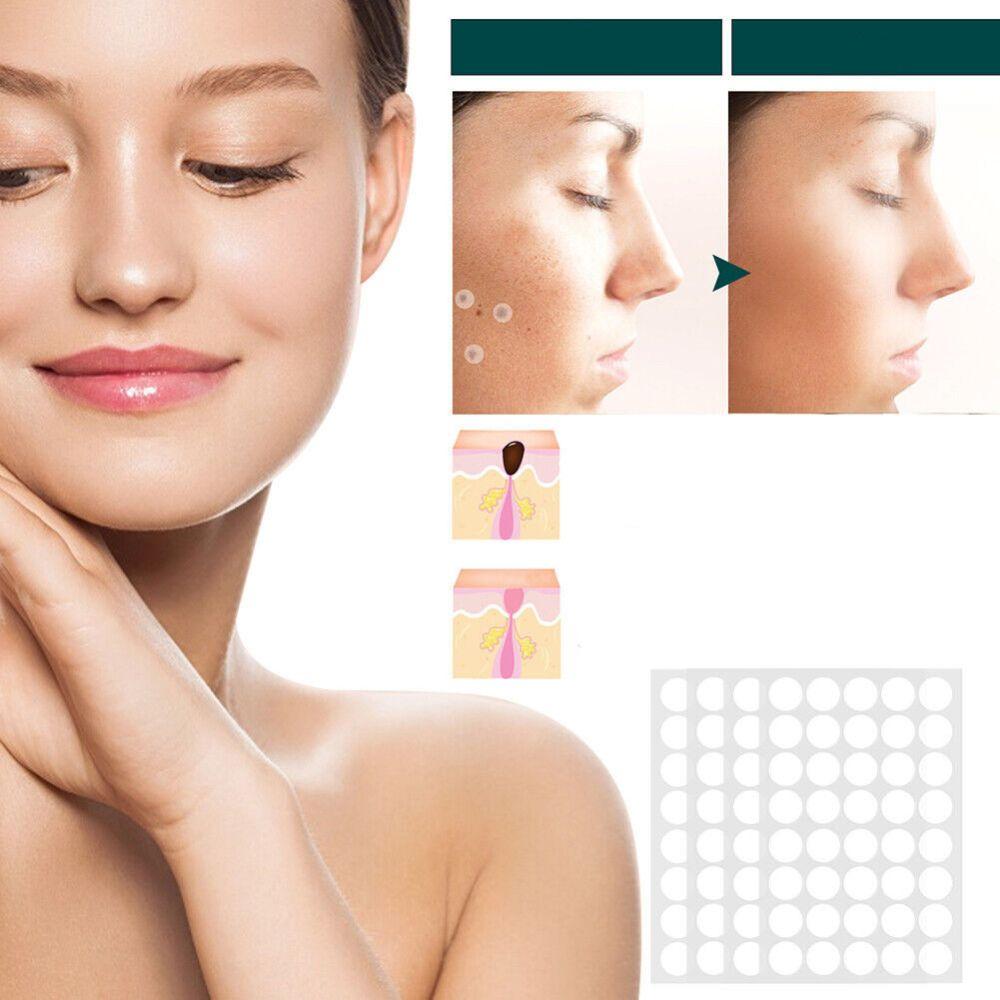 Skin Tag & Wart Patches | Painless & Discreet | 120-Pack