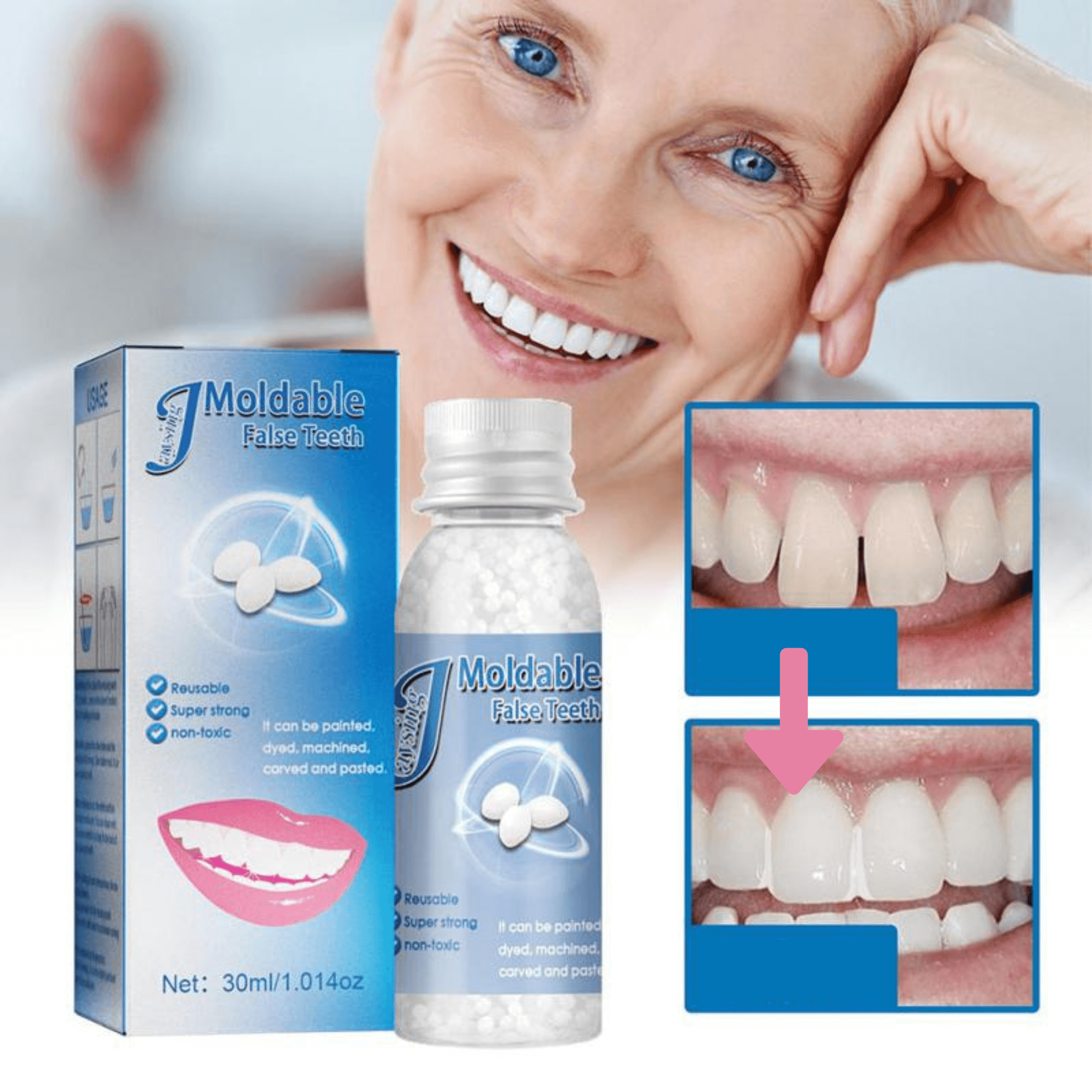 Temporary Tooth Filling Beads | Quick-Setting Moldable Repair | Resin 30ml | Emergency Dental Repair