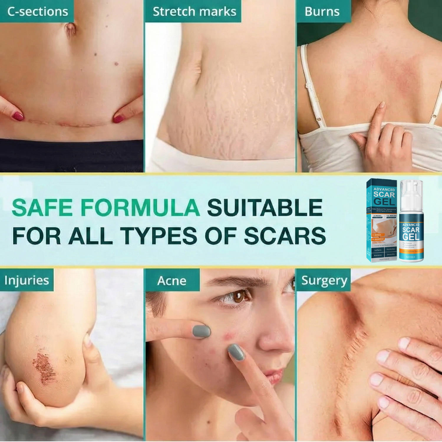 HydraGuard Skin Repair Cream for Scars and Marks