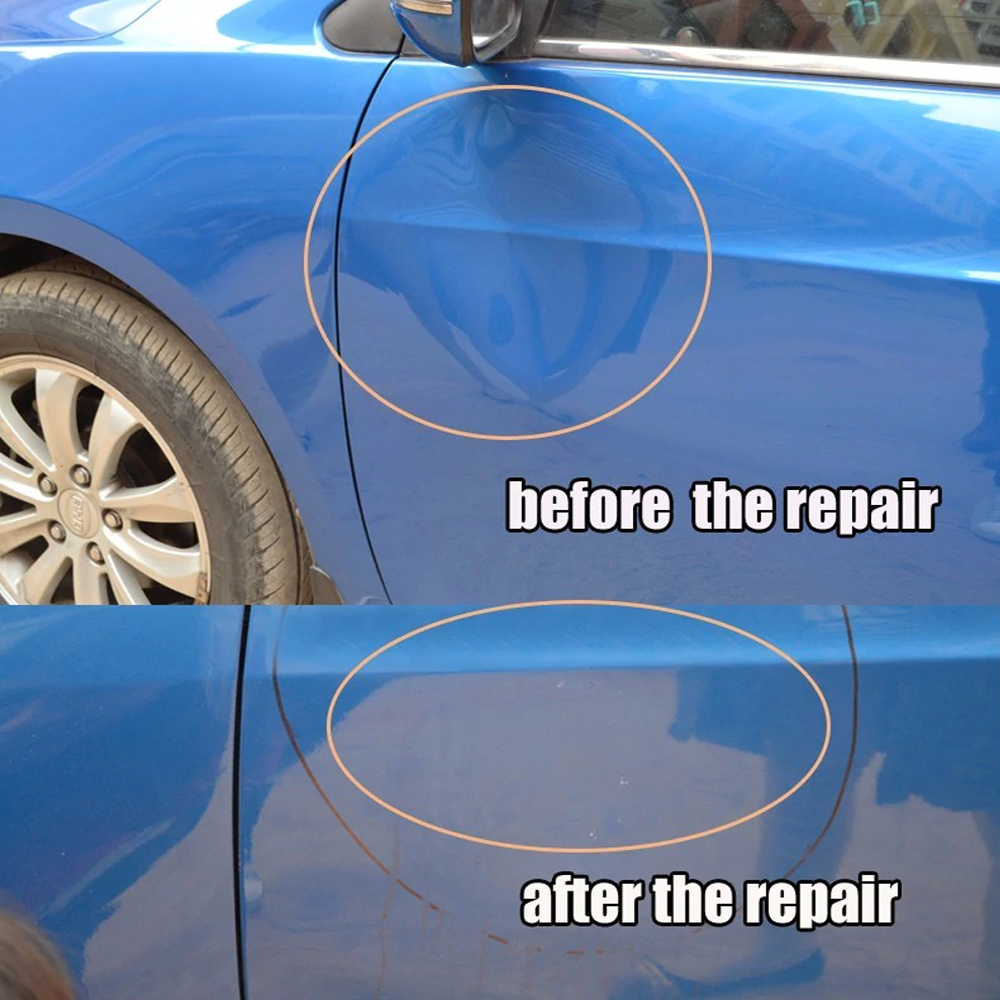 Ultimate Dent Repair Toolkit for Home and Auto