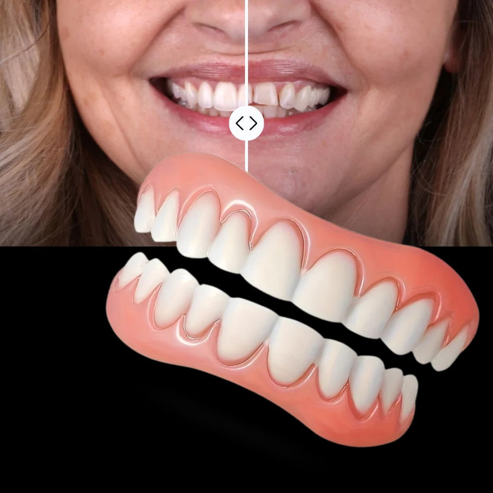 Natural Smile Restoration Kit