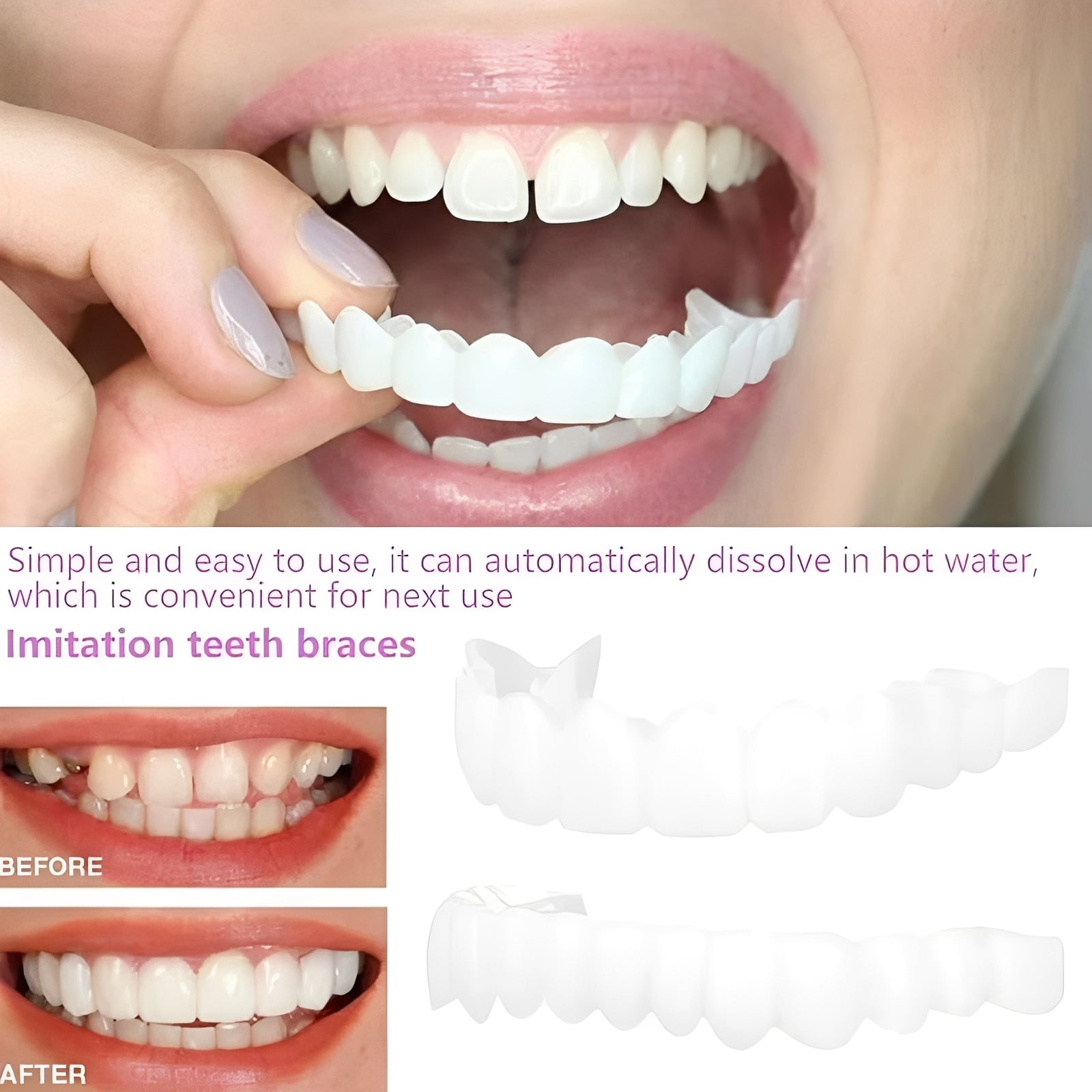 Instant Smile Cosmetic Tooth Covers for Adults - 2 Pack