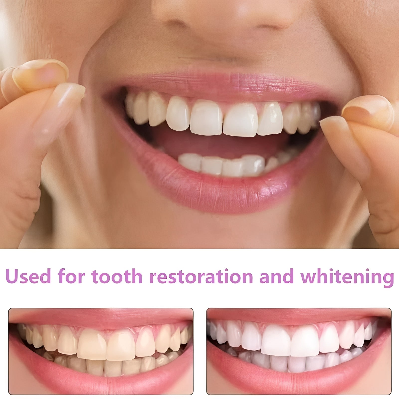 Instant Smile Cosmetic Tooth Covers for Adults - 2 Pack