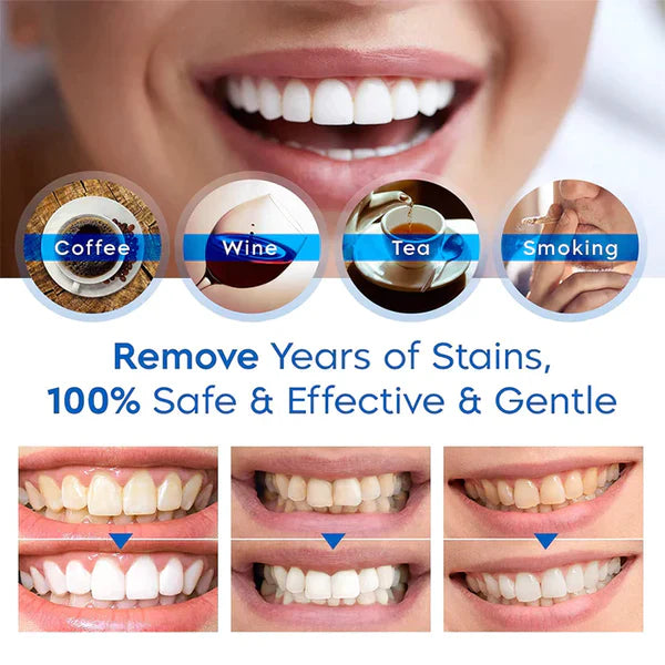 Whitening Pen for Teeth – Dental Brightening Essence