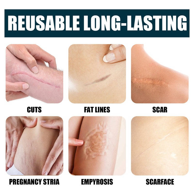 HydraGuard Skin Repair Cream for Scars and Marks
