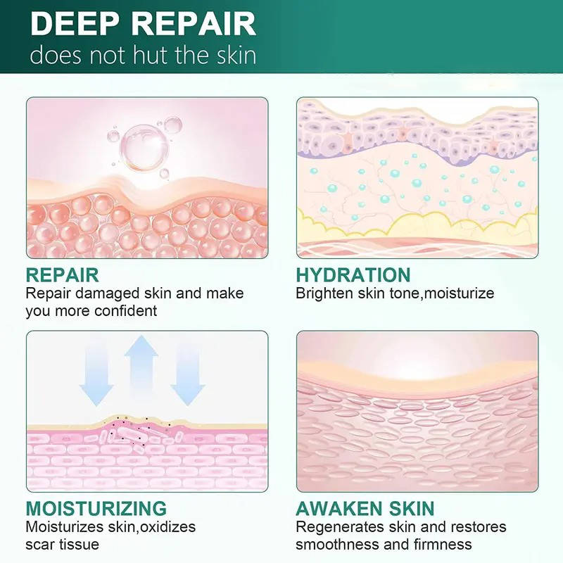 HydraGuard Skin Repair Cream for Scars and Marks
