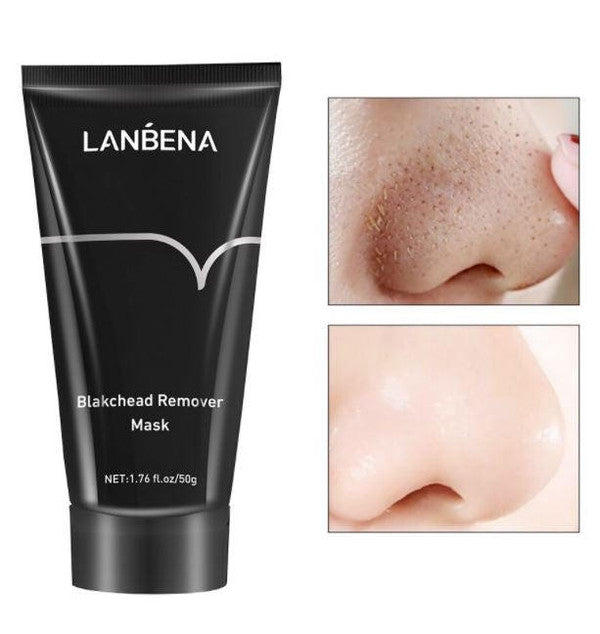 Charcoal Peel-Off Mask for Blackhead Removal