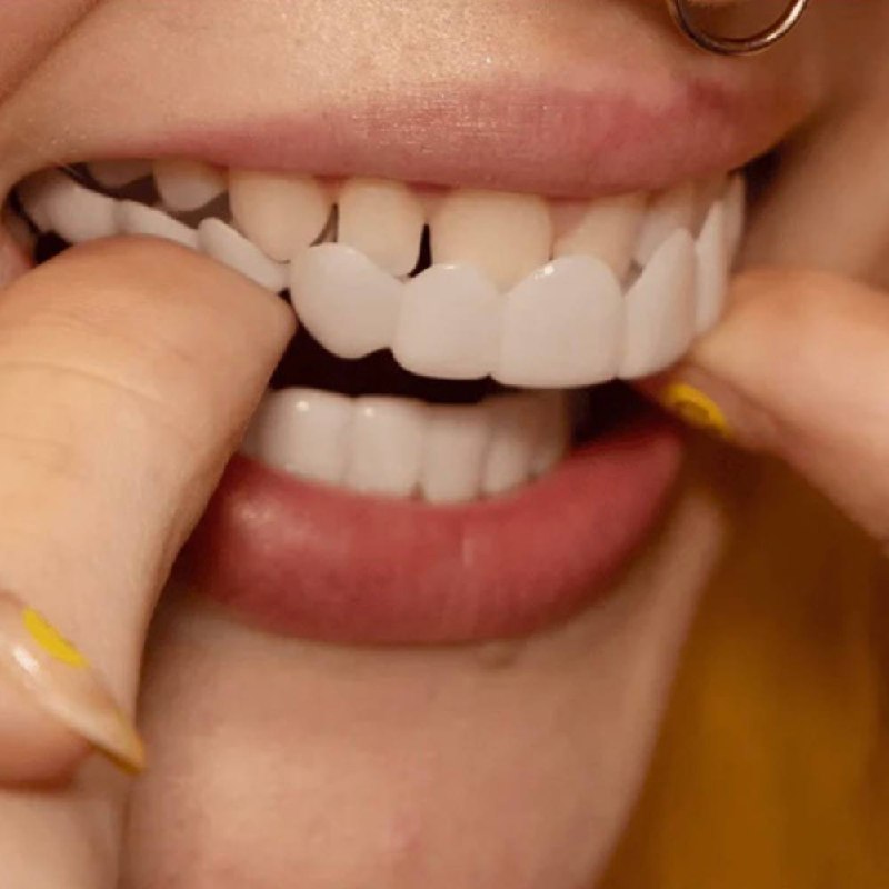 Quick Smile Enhancement Kit for Natural Confidence