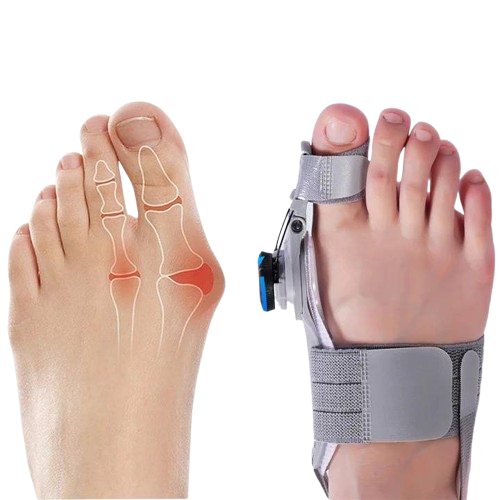 Toe Spacer for Natural Bunion Correction