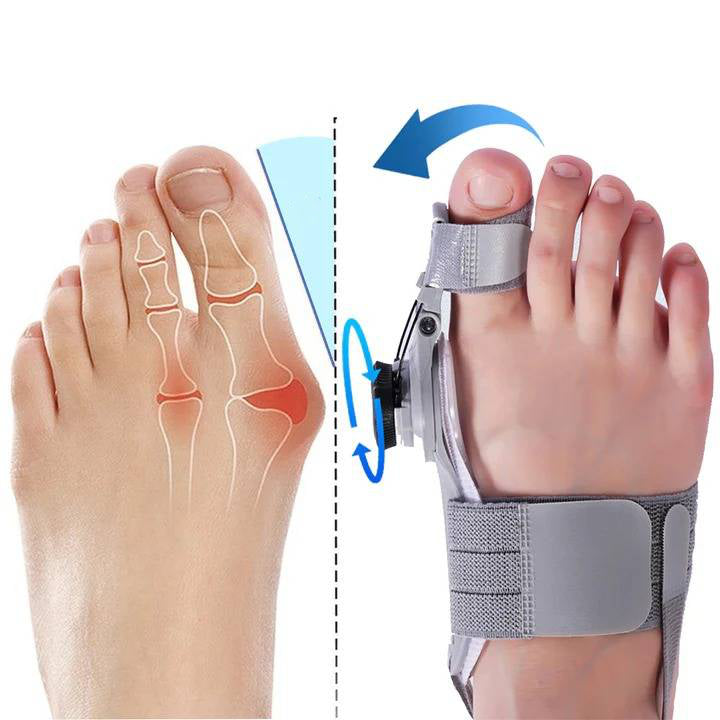 Toe Spacer for Natural Bunion Correction