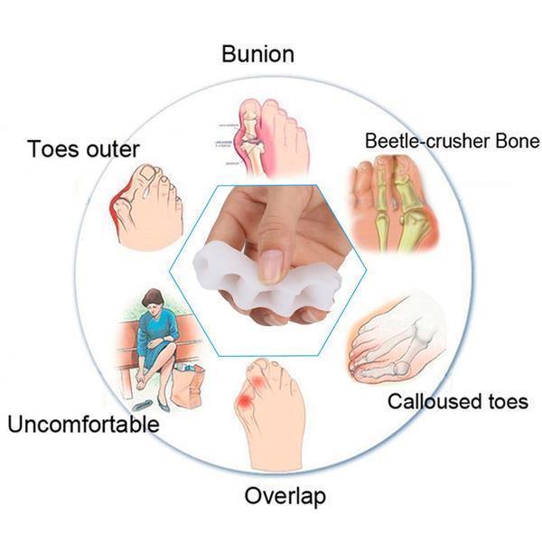 Toe Separator for Orthopedic Alignment and Correction