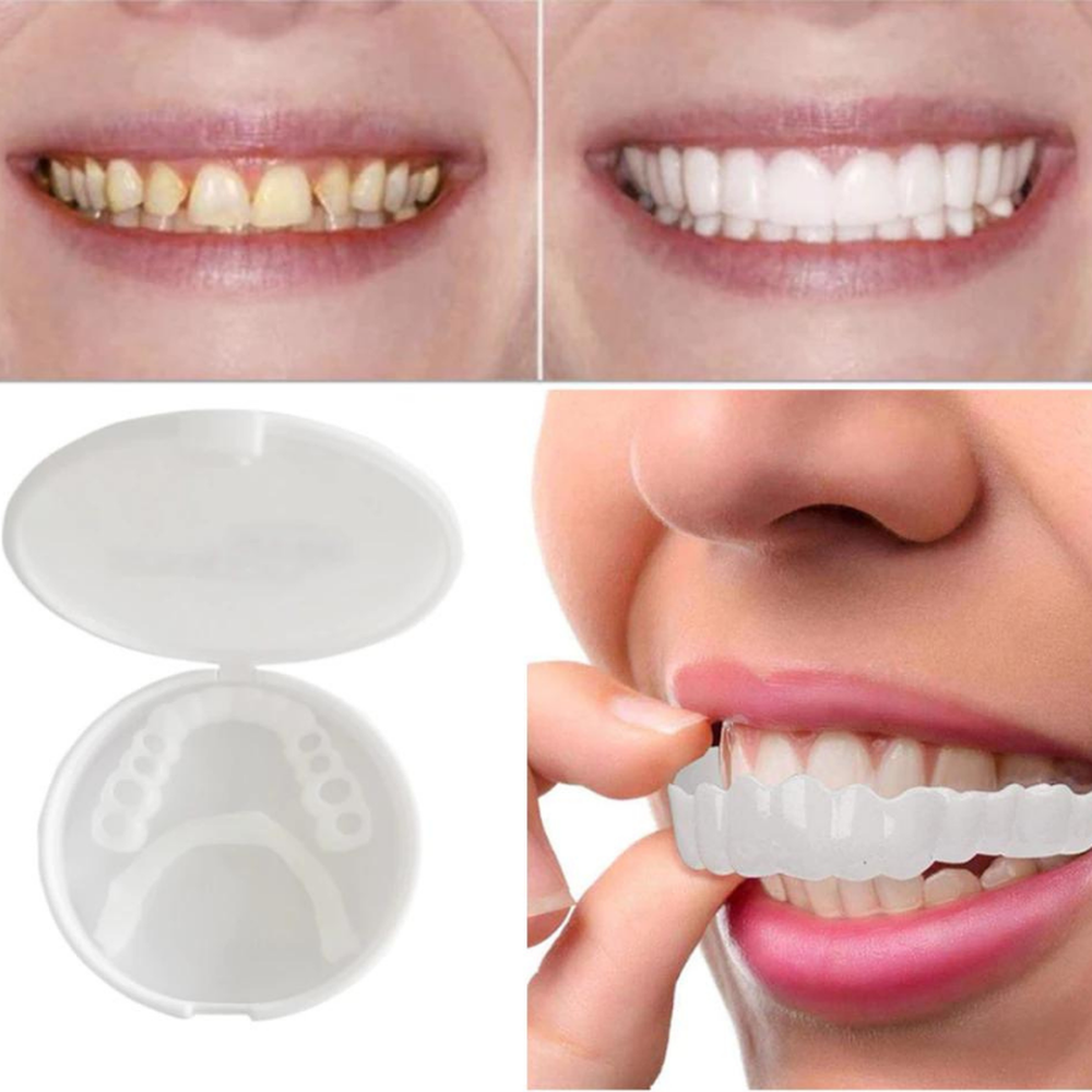 SmileBright Instant Tooth Transformation Kit