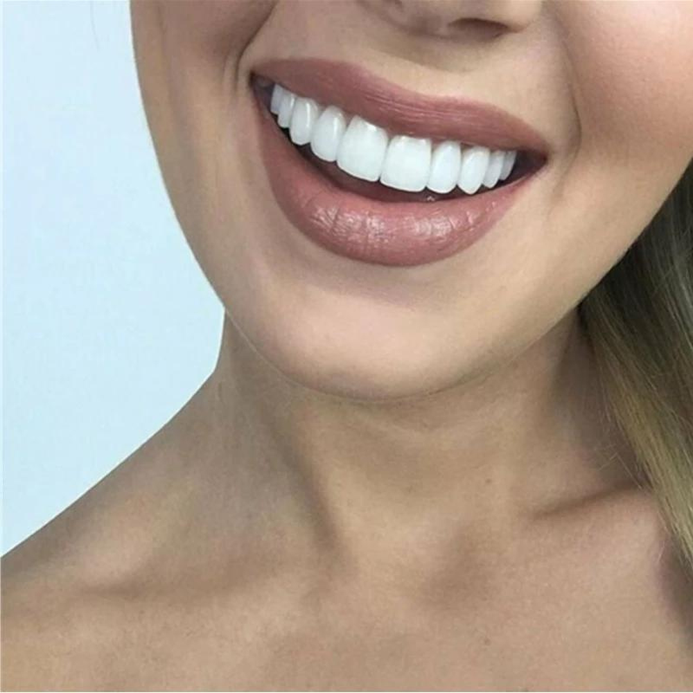 SmileBright Instant Tooth Transformation Kit