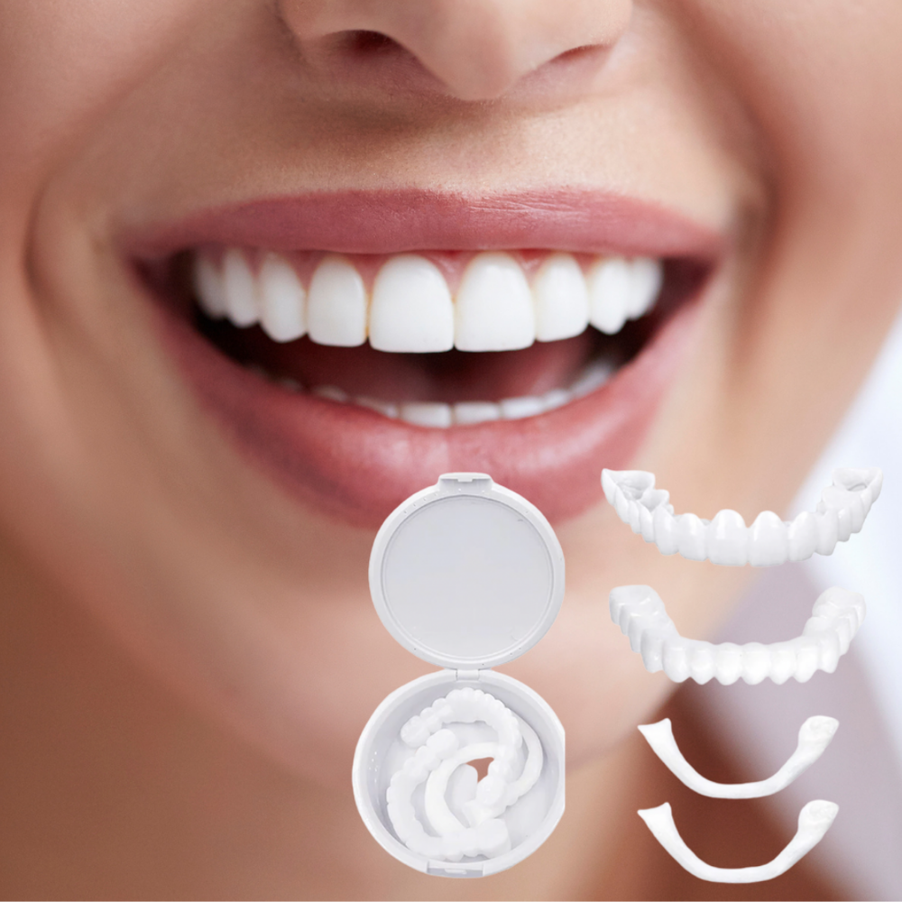SmileBright Instant Tooth Transformation Kit